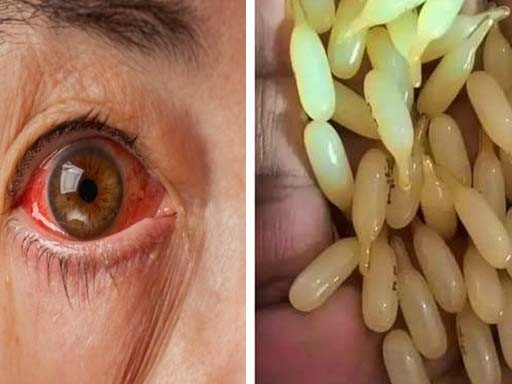 eyeflu 1691322393