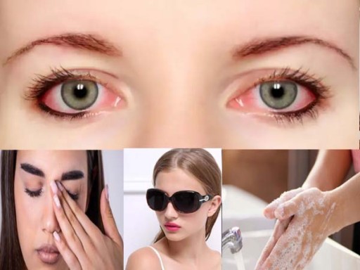 home tips for eye flu 1691491253